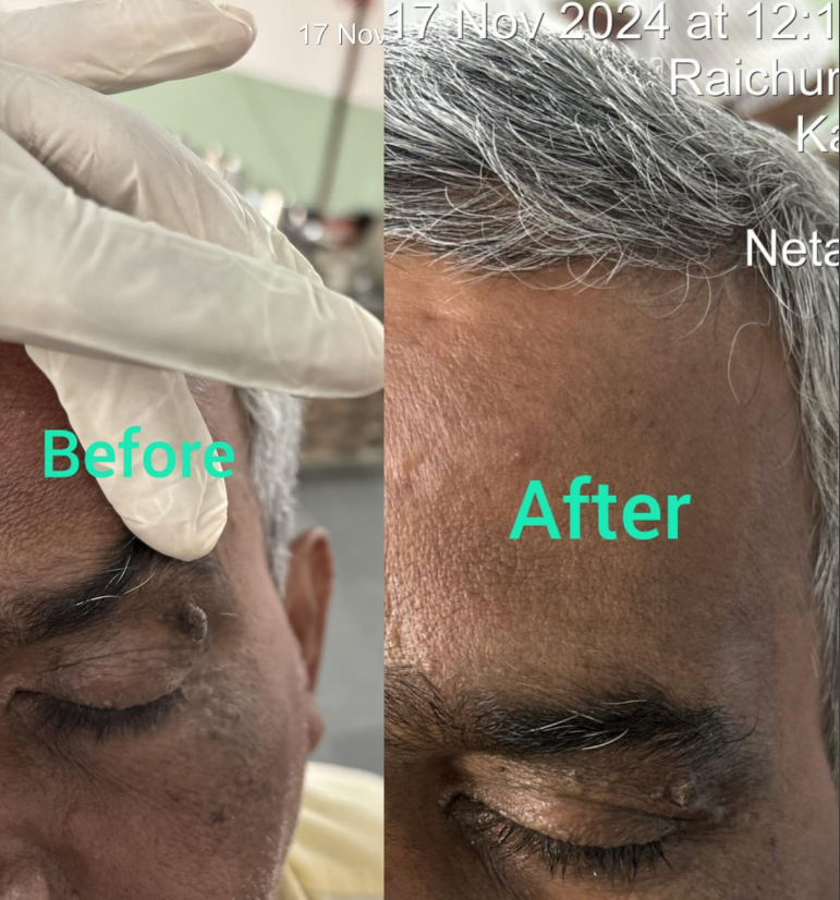 Transformation through Ayurveda